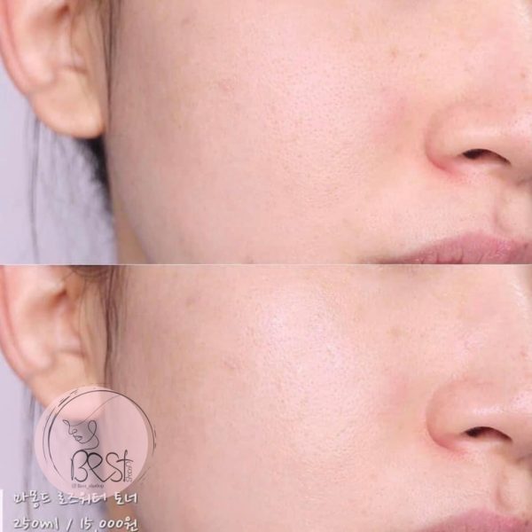 تونر پاک‌کننده منافذ و کنترل‌کننده ترشح سبوم ( مات‌کننده پوست✨ ) برند مموند - Image 6